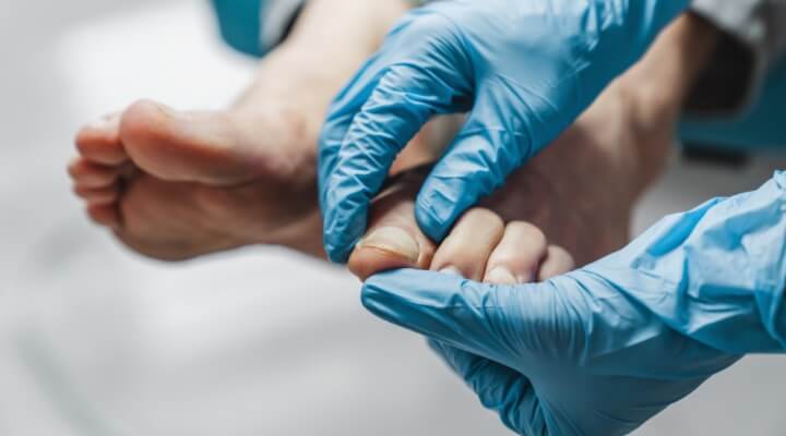 dermatologist inspecting toe nail