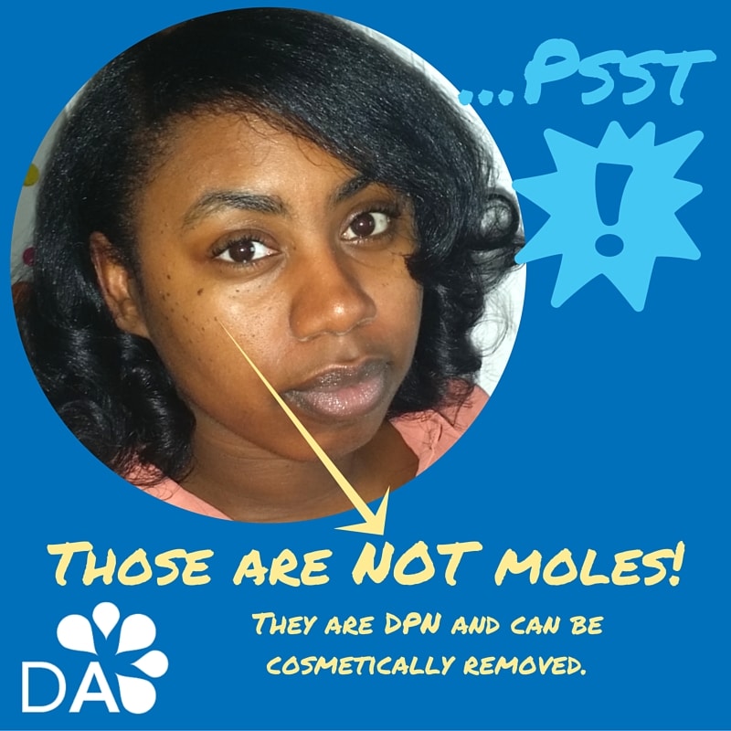 -Psst! not moles